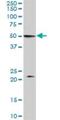 Vacuolar fusion protein MON1 homolog B antibody, H00022879-B01P, Novus Biologicals, Western Blot image 