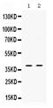 Ring Finger Protein 2 antibody, RP1101, Boster Biological Technology, Western Blot image 