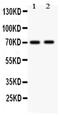 Mitogen-Activated Protein Kinase Kinase Kinase 3 antibody, PA5-79631, Invitrogen Antibodies, Western Blot image 