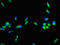 Coagulation Factor VIII antibody, LS-C395862, Lifespan Biosciences, Immunofluorescence image 