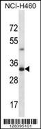 TBC1 Domain Family Member 21 antibody, 57-879, ProSci, Western Blot image 