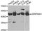 Alpha-1-antitrypsin antibody, A12481, ABclonal Technology, Western Blot image 