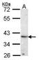 ATPase H+ Transporting Accessory Protein 2 antibody, PA5-29932, Invitrogen Antibodies, Western Blot image 