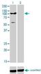 ATPase Secretory Pathway Ca2+ Transporting 1 antibody, H00027032-M01, Novus Biologicals, Western Blot image 