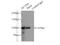 Actinin Alpha 4 antibody, 19096-1-AP, Proteintech Group, Immunoprecipitation image 