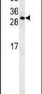 Coiled-Coil Domain Containing 69 antibody, PA5-25380, Invitrogen Antibodies, Western Blot image 