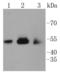 Calcium/Calmodulin Dependent Protein Kinase II Beta antibody, A03964, Boster Biological Technology, Western Blot image 