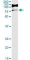 RIO Kinase 3 antibody, H00008780-M01, Novus Biologicals, Immunoprecipitation image 