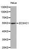 Zinc Finger C3HC-Type Containing 1 antibody, MBS129682, MyBioSource, Western Blot image 