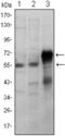 ETS Proto-Oncogene 1, Transcription Factor antibody, GTX83003, GeneTex, Western Blot image 