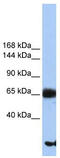 Phosphatidylinositol Glycan Anchor Biosynthesis Class O antibody, TA339619, Origene, Western Blot image 