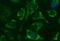 Nipsnap Homolog 2 antibody, MA5-26169, Invitrogen Antibodies, Immunocytochemistry image 