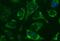 Nipsnap Homolog 2 antibody, MA5-26169, Invitrogen Antibodies, Immunocytochemistry image 