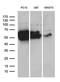 Dihydropyrimidinase Like 2 antibody, MA5-27498, Invitrogen Antibodies, Western Blot image 