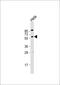 PKB beta antibody, 62-603, ProSci, Western Blot image 