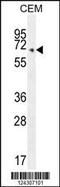 Cytochrome C Oxidase Assembly Factor Heme A:Farnesyltransferase COX10 antibody, 55-363, ProSci, Western Blot image 