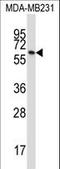 Butyrophilin Subfamily 3 Member A1 antibody, LS-C156888, Lifespan Biosciences, Western Blot image 