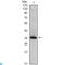 NME/NM23 Nucleoside Diphosphate Kinase 1 antibody, LS-C812722, Lifespan Biosciences, Western Blot image 