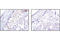Stearoyl-CoA Desaturase antibody, 2794S, Cell Signaling Technology, Immunohistochemistry paraffin image 