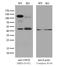 Ubiquitin Specific Peptidase 10 antibody, NBP2-01452, Novus Biologicals, Western Blot image 