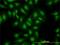 S100 Calcium Binding Protein A13 antibody, H00006284-M01, Novus Biologicals, Immunocytochemistry image 