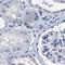 Hemogen antibody, PA5-54037, Invitrogen Antibodies, Immunohistochemistry paraffin image 