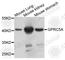 Retinoic acid-induced protein 3 antibody, A8173, ABclonal Technology, Western Blot image 