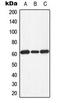 Eukaryotic Translation Initiation Factor 2 Alpha Kinase 2 antibody, LS-C354070, Lifespan Biosciences, Western Blot image 