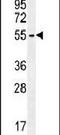 Zinc Finger DHHC-Type Containing 1 antibody, PA5-23820, Invitrogen Antibodies, Western Blot image 