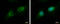 Regulator Of G Protein Signaling 7 antibody, GTX105382, GeneTex, Immunofluorescence image 