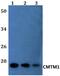 CKLF Like MARVEL Transmembrane Domain Containing 1 antibody, PA5-75877, Invitrogen Antibodies, Western Blot image 