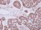 Zinc Finger Protein 148 antibody, NBP2-20964, Novus Biologicals, Immunohistochemistry paraffin image 