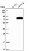 NADH:Ubiquinone Oxidoreductase Subunit V3 antibody, PA5-54082, Invitrogen Antibodies, Western Blot image 