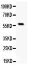 Apurinic/Apyrimidinic Endodeoxyribonuclease 2 antibody, PA1495, Boster Biological Technology, Western Blot image 