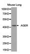 RAGE antibody, TA327041, Origene, Western Blot image 