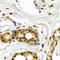 Activating Transcription Factor 2 antibody, LS-C331946, Lifespan Biosciences, Immunohistochemistry paraffin image 