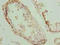 Pleckstrin Homology Domain Containing J1 antibody, orb37064, Biorbyt, Immunohistochemistry paraffin image 
