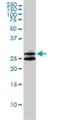 Ankyrin Repeat And SOCS Box Containing 9 antibody, H00140462-M01, Novus Biologicals, Western Blot image 