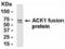 ACK1 antibody, XW-7864, ProSci, Western Blot image 