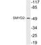 SET And MYND Domain Containing 2 antibody, LS-C200005, Lifespan Biosciences, Western Blot image 