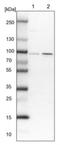 Sarcolemma Associated Protein antibody, NBP1-81398, Novus Biologicals, Western Blot image 
