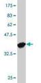 Serine/threonine-protein kinase TAO2 antibody, H00009344-M08, Novus Biologicals, Western Blot image 