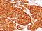 Tyrosinase antibody, NBP2-48119, Novus Biologicals, Immunohistochemistry paraffin image 