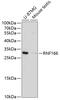 Ring Finger Protein 166 antibody, 13-869, ProSci, Western Blot image 