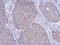 Phenylalanyl-TRNA Synthetase Subunit Beta antibody, NBP2-16430, Novus Biologicals, Immunohistochemistry frozen image 