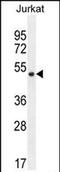 Smad Nuclear Interacting Protein 1 antibody, PA5-71662, Invitrogen Antibodies, Western Blot image 