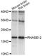 Ribonuclease A Family Member 12 (Inactive) antibody, LS-C749608, Lifespan Biosciences, Western Blot image 