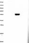 THAP Domain Containing 5 antibody, NBP1-92497, Novus Biologicals, Western Blot image 