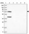 Leiomodin 1 antibody, PA5-55848, Invitrogen Antibodies, Western Blot image 