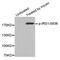 Insulin Receptor Substrate 1 antibody, MBS128253, MyBioSource, Western Blot image 